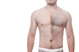 腹毛が濃い原因と男性が取るべき対策 メンズ脱毛百科事典 リンクスペディア