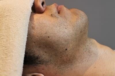 濃いヒゲを薄くする方法は？青髭対策は生活習慣の改善からヒゲ脱毛おすすめ！