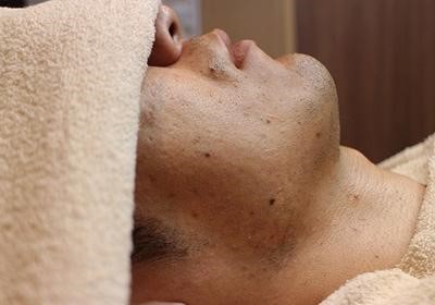 濃いヒゲを薄くする方法は？青髭対策は生活習慣の改善からヒゲ脱毛おすすめ！