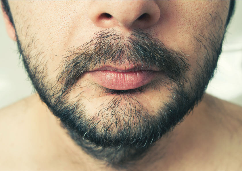 青ひげ 髭 の原因と対策 剃り方のコツや青ひげを消す方法も メンズ脱毛百科事典 リンクスペディア