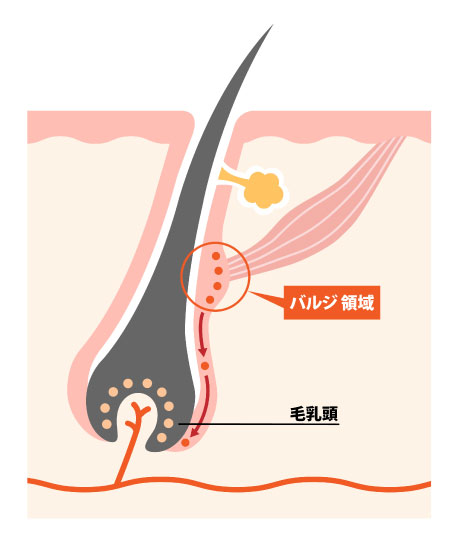 バルジ 脱毛 効果