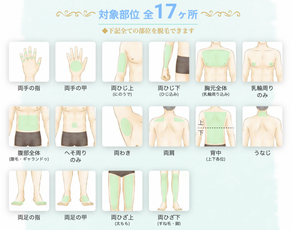 メンズ脱毛 全身 男性におすすめする理由 料金はどれくらい メンズ脱毛百科事典 リンクスペディア