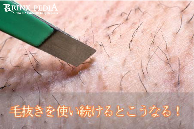 ヒゲ抜きは肌荒れのリスク 正しい処理法や脱毛のメリットを紹介 メンズ脱毛百科事典 リンクスペディア