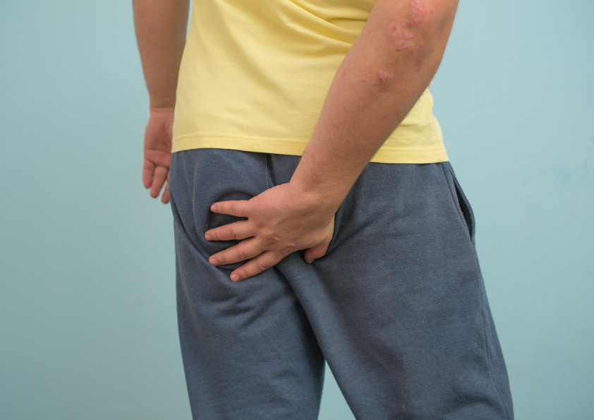 お尻の毛は必要なの 男性におすすめの 尻毛 けつ毛 脱毛 とは メンズ脱毛百科事典 リンクスペディア