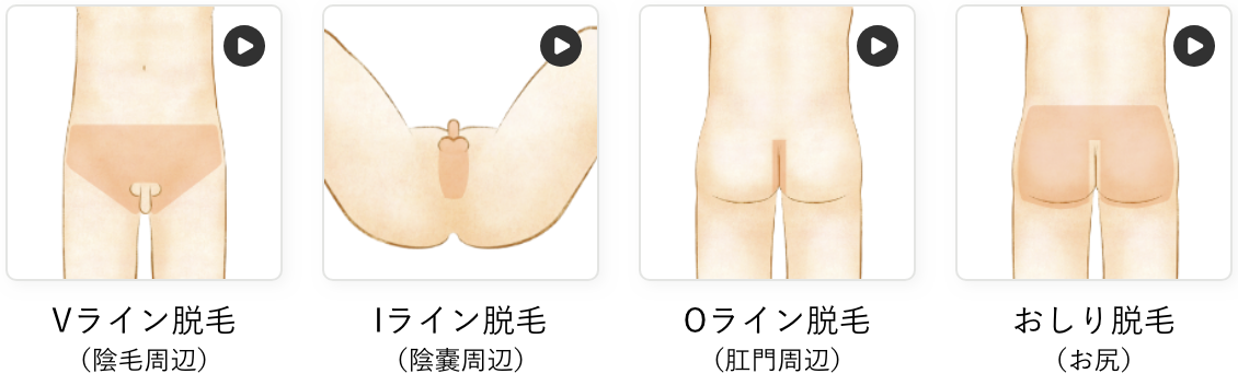 VIOお尻部位