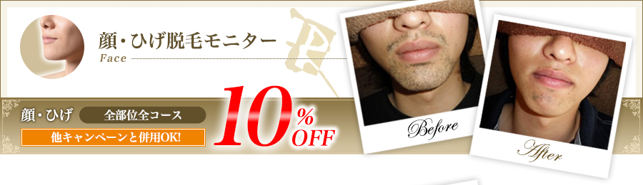 顔・ひげ脱毛モニター全部位全コース他キャンペーンと併用OK!10%OFF