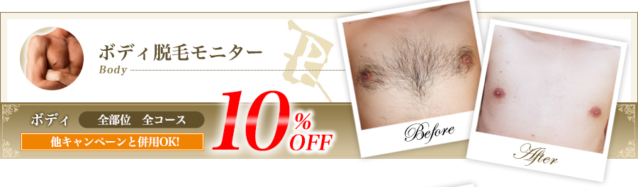 ボディ脱毛モニター全部位全コース他キャンペーンと併用OK!10%OFF