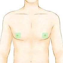 乳輪周り