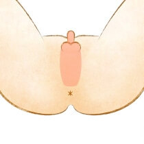Iライン