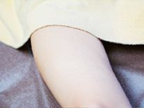 あご下・首ヒゲ脱毛の肌状のチェック写真