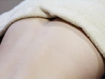 あご下・首ヒゲ脱毛の肌状のチェック写真