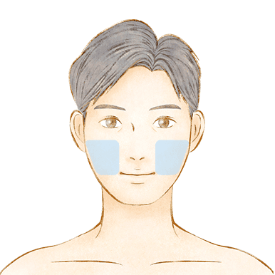 ほほひげ脱毛のイメージ