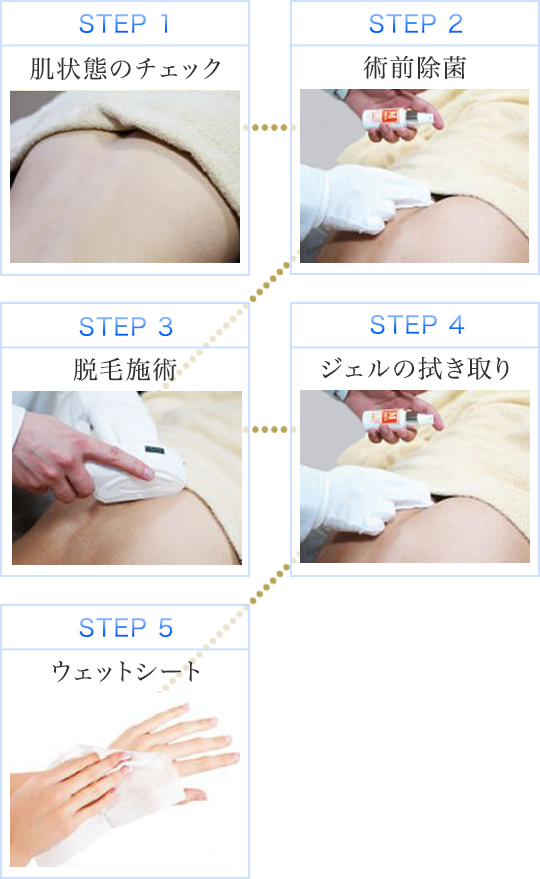 綺麗なoライン 脱毛 メンズ 自由 髪型 コレクション