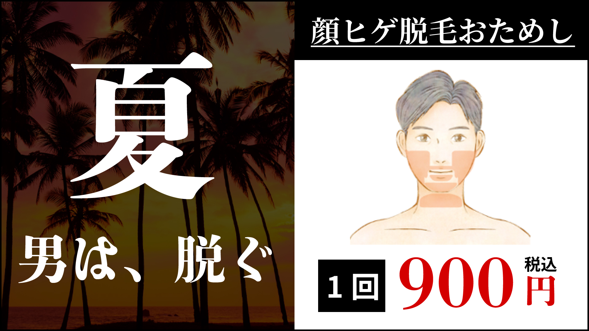 キャンペーン